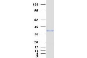 Radical S-Adenosyl Methionine Domain Containing 2 (RSAD2) protein (Myc-DYKDDDDK Tag)