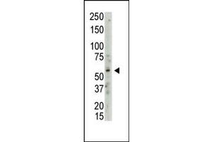 Western blot analysis of anti-PRMT3 Pab (ABIN387839 and ABIN2843941) in whole HL60 cell lysate: PRMT3 (Arrow) was detected using purified Pab (Lane B) but not pre-immune serum (lane A). (PRMT3 antibody  (C-Term))