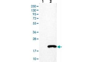 Western blot analysis of Lane 1: Negative control (vector only transfected HEK293T lysate). (LGALS7 antibody)