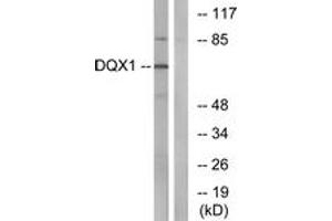 Western blot analysis of extracts from COS7 cells, using DQX1 Antibody.