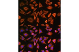 Immunofluorescence analysis of L929 cells using CNOT1 Rabbit pAb (ABIN6127561, ABIN6138777, ABIN6138778 and ABIN6221649) at dilution of 1:100. (CNOT1 antibody  (AA 2137-2376))