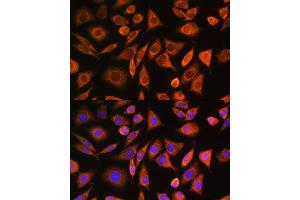 Immunofluorescence analysis of L929 cells using CNOT1 Rabbit pAb (ABIN6127561, ABIN6138777, ABIN6138778 and ABIN6221649) at dilution of 1:100. (CNOT1 antibody  (AA 2137-2376))