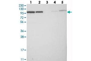 Western blot analysis of Lane 1: RT-4, Lane 2: U-251 MG, Lane 3: Human Plasma, Lane 4: Liver, Lane 5: Tonsil with BICD2 polyclonal antibody  at 1:250-1:500 dilution. (BICD2 antibody)