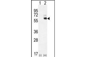 Western blot analysis of KNG1 (arrow) using rabbit polyclonal KNG1 Antibody (N-term) (ABIN655629 and ABIN2845108). (KNG1 antibody  (N-Term))