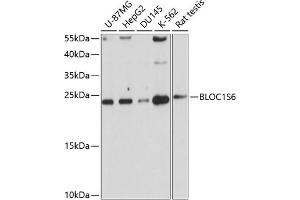 Western blot analysis of extracts of various cell lines, using BLOC1S6 antibody (ABIN1682201, ABIN3019101, ABIN3019102 and ABIN6220714) at 1:1000 dilution. (Pallidin antibody  (AA 1-170))