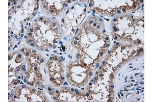 Immunohistochemical staining of paraffin-embedded Kidney tissue using anti-AKT2mouse monoclonal antibody. (AKT2 antibody)