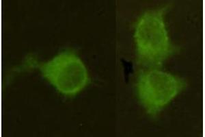 Immunocytochemistry stain of Hela using Mannose Phosphate Isomerase mouse mAb (1:300). (MPI antibody)