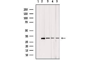 Western blot analysis of extracts from various samples, using MRPL2 Antibody. (MRPL2 antibody  (C-Term))