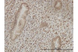 Immunoperoxidase of monoclonal antibody to CSTF2 on formalin-fixed paraffin-embedded human endometrium tissue. (CSTF2 antibody  (AA 1-577))