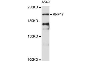 Western blot analysis of extracts of A-549 cells, using RNF17 antibody (ABIN6291205) at 1:3000 dilution. (RNF17 antibody)