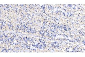 Detection of ASPH in Human Stomach Tissue using Polyclonal Antibody to Aspartate Beta Hydroxylase (ASPH) (Aspartate beta Hydroxylase antibody  (AA 345-758))
