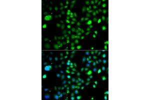 Immunofluorescence analysis of A549 cells using PRDM5 antibody (ABIN5975510).
