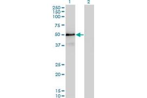 Western Blot analysis of SMAD3 expression in transfected 293T cell line by SMAD3 monoclonal antibody (M20), clone 4F9. (SMAD3 antibody  (AA 147-270))