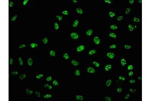 Immunofluorescence (IF) image for anti-Tumor Protein P53 (TP53) (pSer33) antibody (ABIN7127757)