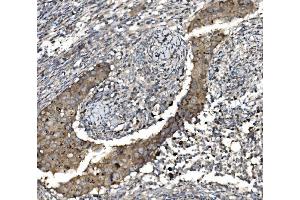 IHC analysis of Claudin 3/CLDN3 using anti-Claudin 3/CLDN3 antibody (ABIN7599626).