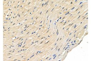 ABIN6262765 and ABIN6278912 at 1/100 staining Rat heart tissue by IHC-P.