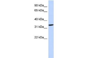 WB Suggested Anti-AZGP1 Antibody Titration: 0. (AZGP1 antibody  (N-Term))