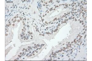 Image no. 14 for anti-Glial Fibrillary Acidic Protein (GFAP) antibody (ABIN1498440) (GFAP antibody)