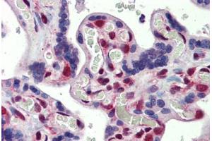 Placenta, Human: Formalin-Fixed, Paraffin-Embedded (FFPE) (FUBP3 antibody  (AA 503-552))