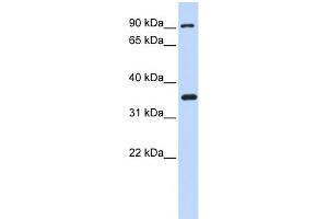 Western Blotting (WB) image for anti-Inhibitor of kappa Light Polypeptide Gene Enhancer in B-Cells, Kinase beta (IKBKB) (N-Term) antibody (ABIN2779787)