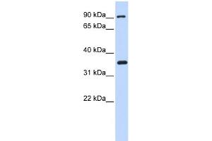 WB Suggested Anti-IKBKB Antibody Titration: 0. (IKBKB antibody  (N-Term))