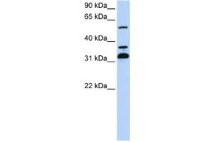 Western Blotting (WB) image for anti-Tripartite Motif Containing 9 (TRIM9) antibody (ABIN2458110) (TRIM9 antibody)