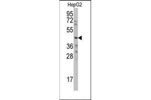 Image no. 2 for anti-Wnt1 Inducible Signaling Pathway Protein 3 (WISP3) (Middle Region) antibody (ABIN358747) (WISP3 antibody  (Middle Region))