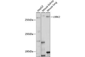 Western blot analysis of extracts of various cell lines, using LRRK2 Polyclonal Antibody  at 1:1000 dilution. (LRRK2 antibody  (AA 2355-2527))