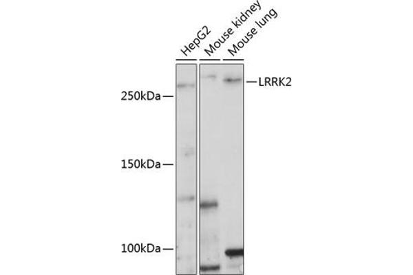 LRRK2 抗体  (AA 2355-2527)