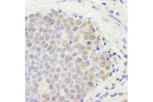 Immunohistochemistry (IHC) image for anti-GATA Zinc Finger Domain Containing 2B (GATAD2B) (AA 50-100) antibody (ABIN7448709) (GATAD2B antibody  (AA 50-100))
