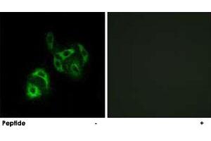 Immunofluorescence analysis of A-549 cells, using SLC27A4 polyclonal antibody . (SLC27A4 antibody)