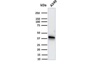 Western Blot Analysis of human A549 cell lysate using Annexin A1 Mouse Monoclonal Antibody (CPTC-ANXA1-1). (Annexin a1 antibody)