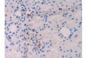 Used in DAB staining on fromalin fixed paraffin- embedded kidney tissue (IL-18 antibody  (AA 37-193))
