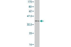 Western Blot detection against Immunogen (35. (NFKBIB antibody  (AA 56-145))