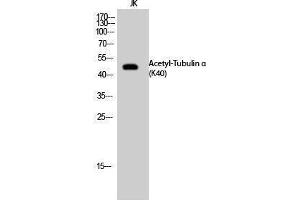 Western Blotting (WB) image for anti-alpha Tubulin (TUBA1) (acLys40) antibody (ABIN3172844) (alpha Tubulin antibody  (acLys40))
