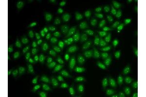 Immunofluorescence analysis of HeLa cells using COIL antibody. (Coilin antibody  (AA 297-576))