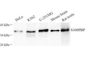 Western blot analysis of S100PBP (ABIN7075500) at dilution of 1: 100 (S100PBP antibody)