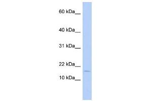 WB Suggested Anti-ISCA2 Antibody Titration: 0. (ISCA2 antibody  (Middle Region))