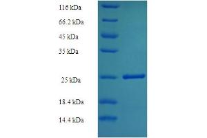 SDS-PAGE (SDS) image for Vasohibin 1 (VASH1) (AA 1-204) protein (His tag) (ABIN4975588) (VASH1 Protein (AA 1-204) (His tag))