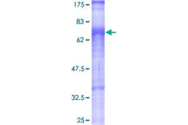 TGFBRAP1 Protein (AA 1-860) (GST tag)