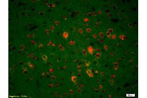 Formalin-fixed and paraffin-embedded rat brain labeled with Anti-Endo G Polyclonal Antibody, Unconjugated (ABIN680893) 1:200, overnight at 4°C, The secondary antibody was Goat Anti-Rabbit IgG, Cy3 conjugated used at 1:200 dilution for 40 minutes at 37°C. (Endonuclease G antibody  (AA 101-200))