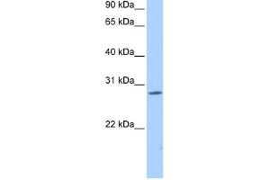 WB Suggested Anti-NRIP3 Antibody Titration:  0.