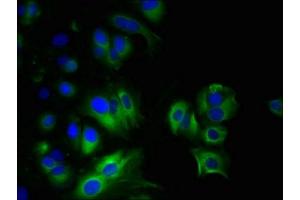 Immunofluorescent analysis of MCF-7 cells using ABIN7160482 at dilution of 1:100 and Alexa Fluor 488-congugated AffiniPure Goat Anti-Rabbit IgG(H+L) (MYADM antibody  (AA 1-40))