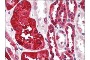 Human Kidney (formalin-fixed, paraffin-embedded) stained with FTH1at 4 µg/ml followed by biotinylated anti-goat IgG secondary antibody, alkaline phosphatase-streptavidin and chromogen. (FTH1 antibody  (C-Term, Heavy Chain))