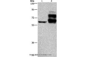 Western blot analysis of Jurkat cell and human rectal cancer tissue, using PCSK9 Polyclonal Antibody at dilution of 1:200