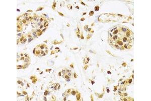 Immunohistochemistry of paraffin-embedded Human breast using SEPHS1 Polyclonal Antibody at dilution of 1:100 (40x lens).