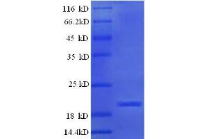 SDS-PAGE (SDS) image for Ephrin A5 (EFNA5) (AA 21-203) protein (His tag) (ABIN5709445) (Ephrin A5 Protein (EFNA5) (AA 21-203) (His tag))