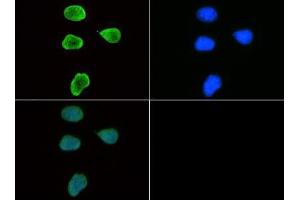 Immunofluorescence of Rabbit Anti-Histone H3 [Trimethyl Lys9] Antibody. (Histone 3 antibody  (H3K9me3))