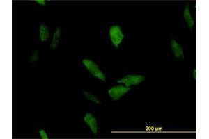 Immunofluorescence of monoclonal antibody to LRRFIP1 on HeLa cell. (LRRFIP1 antibody  (AA 675-784))