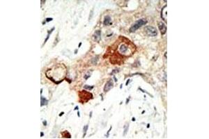 Image no. 1 for anti-Ubiquitin-Conjugating Enzyme E2I (UBE2I) (N-Term) antibody (ABIN356594) (UBE2I antibody  (N-Term))